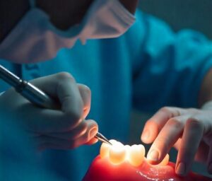 Top 4 Basic Instruments in Dentistry for Every Dentist